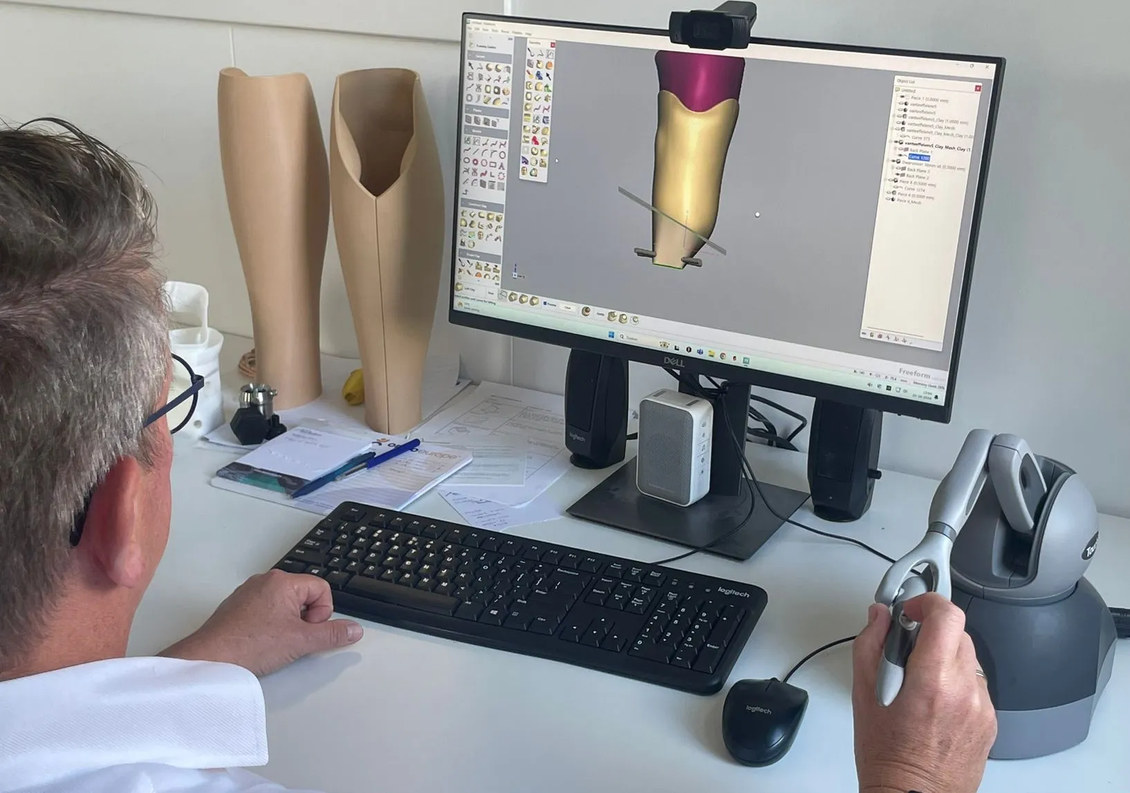 Designing a prosthesis for 3D printing